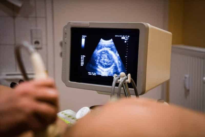 Ultrasound of mother's womb